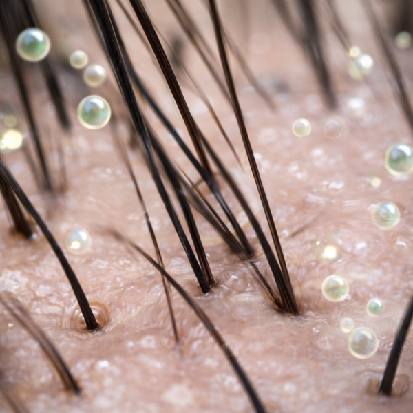 Scalp Clera Complex